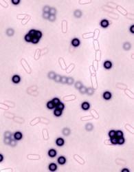 bacterium